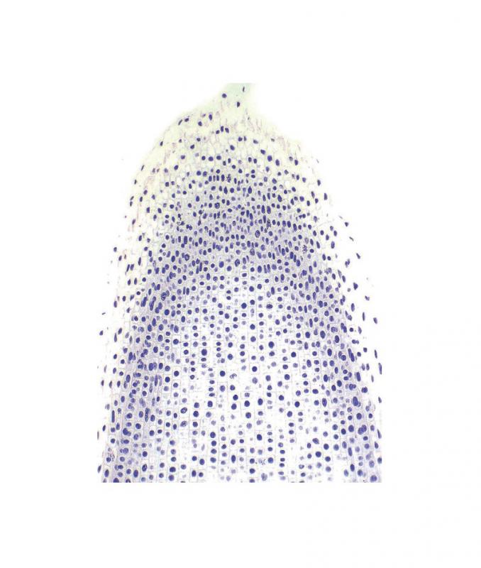 Préparation microscopique: Renoncule racine CT