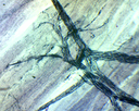 Cellules nerveuses moelle - Terminaison de motoneurone - CT