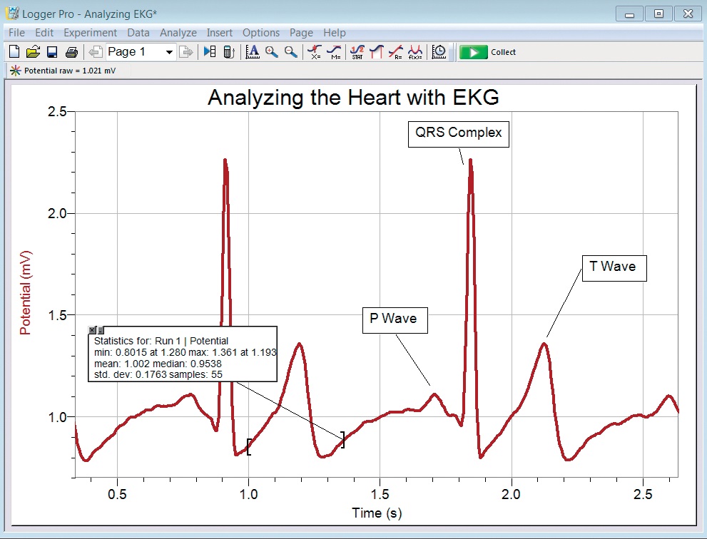 Capteur ECG/EMG