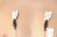 Electrodes adhésives pince croco (lot de 100)