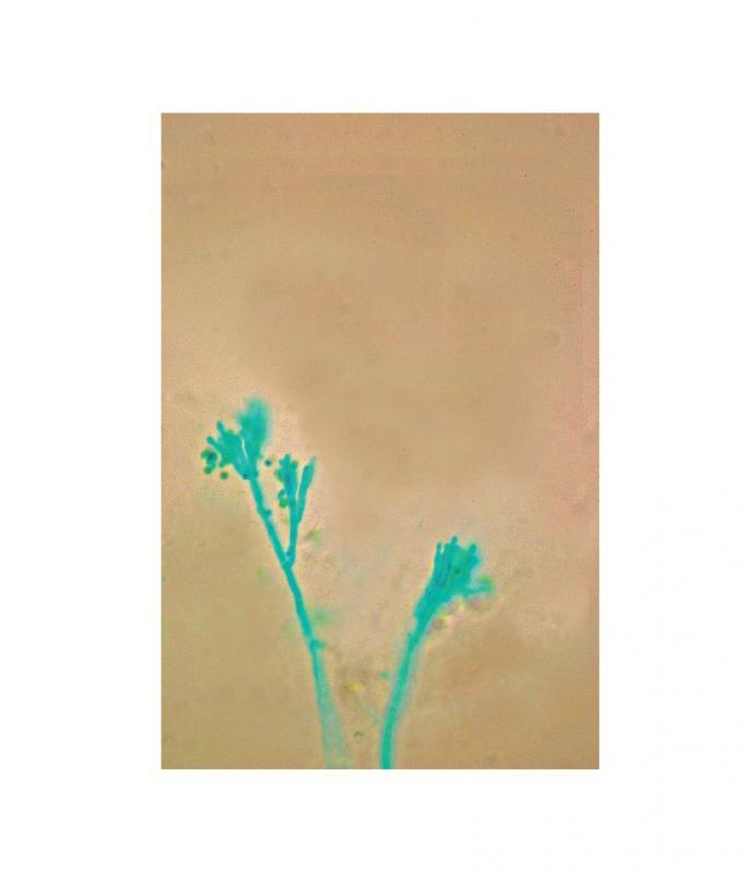 Préparation microscopique: Zygorhrynchus zygospores