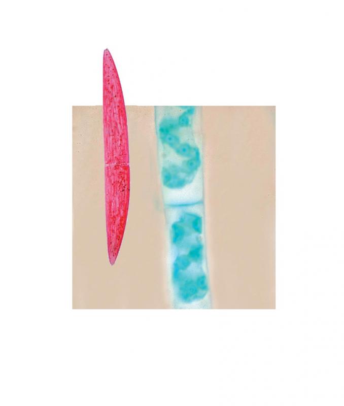 Préparation microscopique: Algues: Fucus vésiculeux mâle - réceptacle