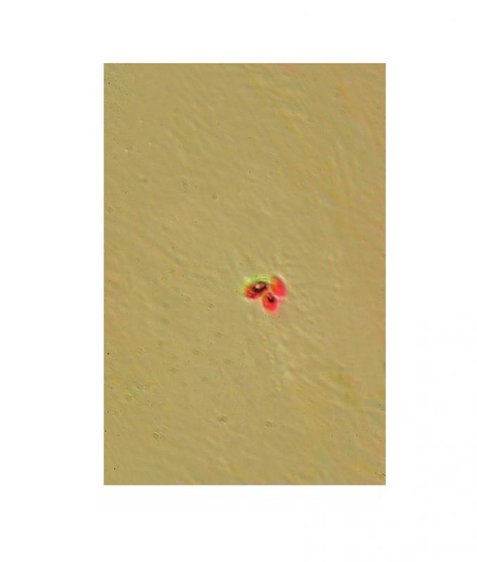 [027111-S60488] Préparation microscopique: Penicillium appareil conidien