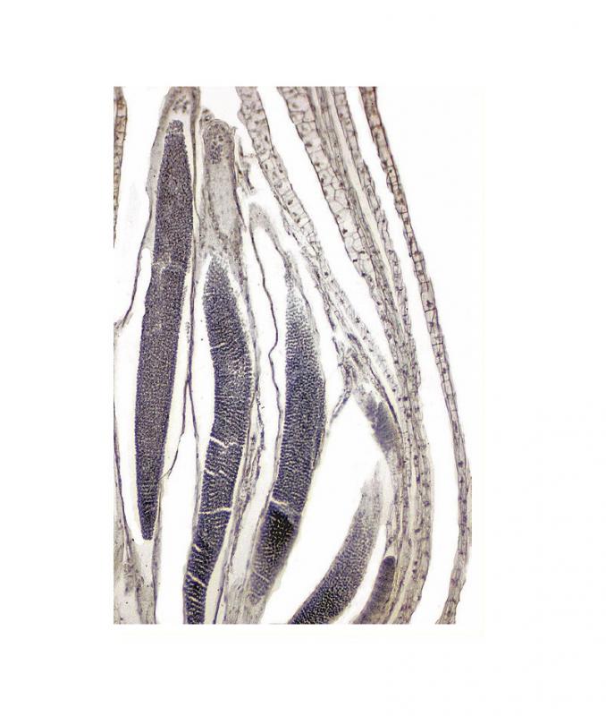 Préparation microscopique: Archégone de mousse pied femelle