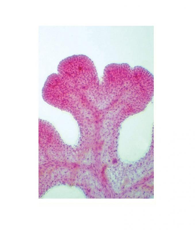 Préparation microscopique: Prothalle avec sporophytes