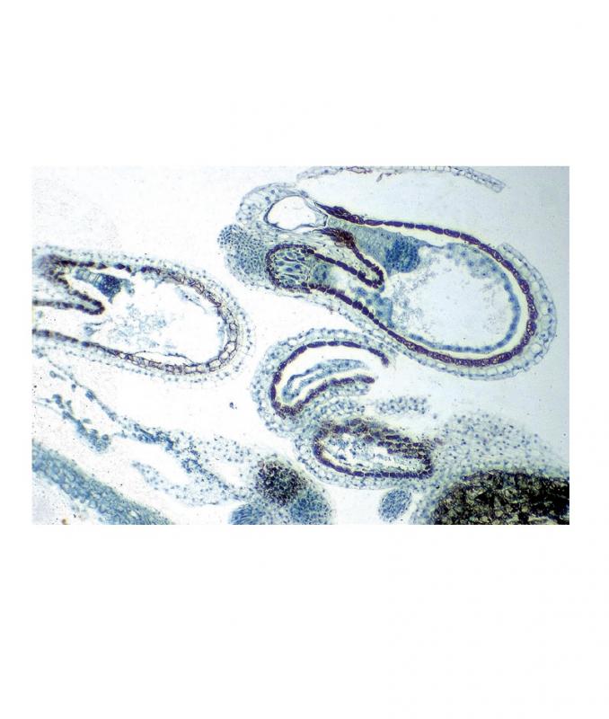 [027119-S60540] Préparation microscopique: Stigmate avec pollen mauve