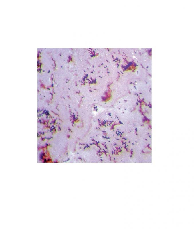 Préparation microscopique: Bactéries de flore intestinale
