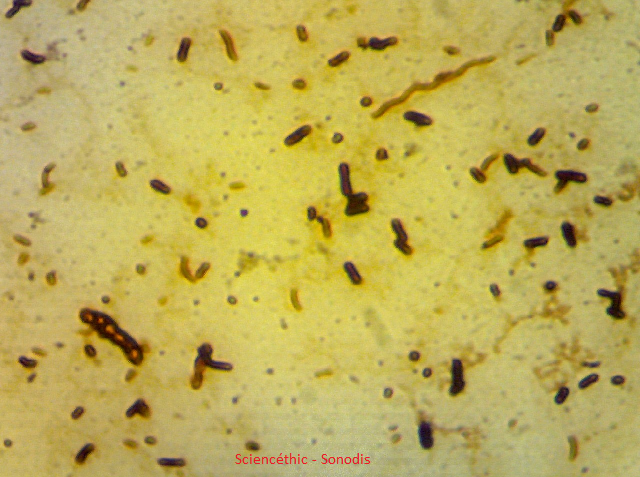 Préparation microscopique: 3 types de bactéries 