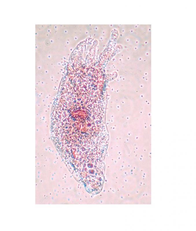 Préparation microscopique: Foraminifères fossiles (mélange)