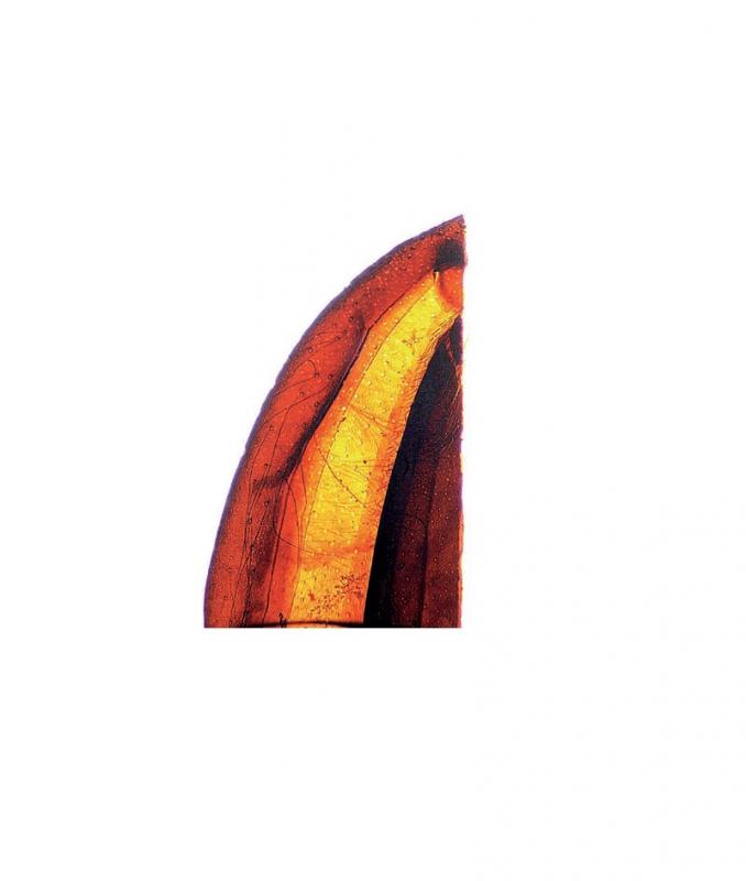 Préparation microscopique: Tête de guêpe