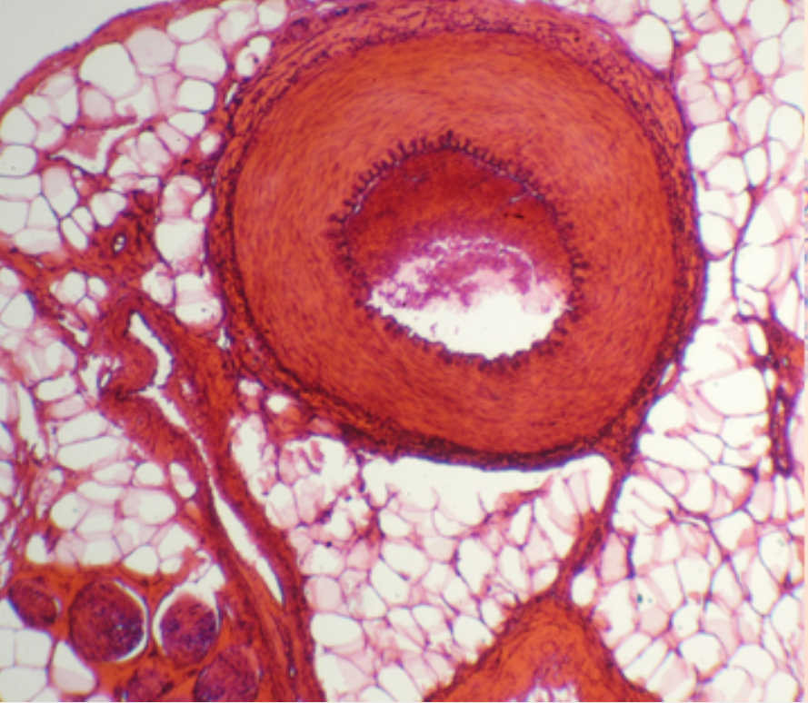 [#027012-S01127] Préparation microscopique: Artère et veine - CT
