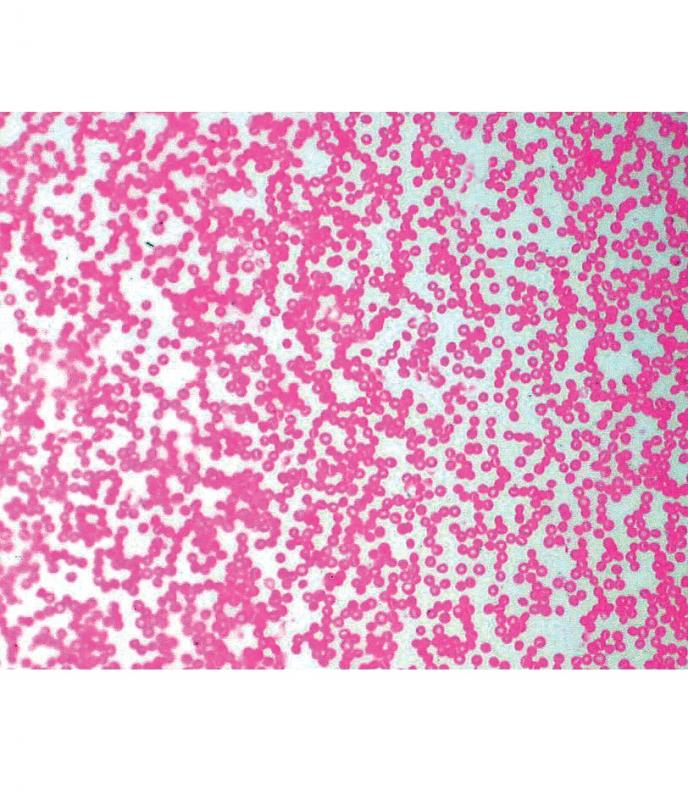 [027399-S60407] Préparation microscopique: Frottis moelle osseuse rouge 