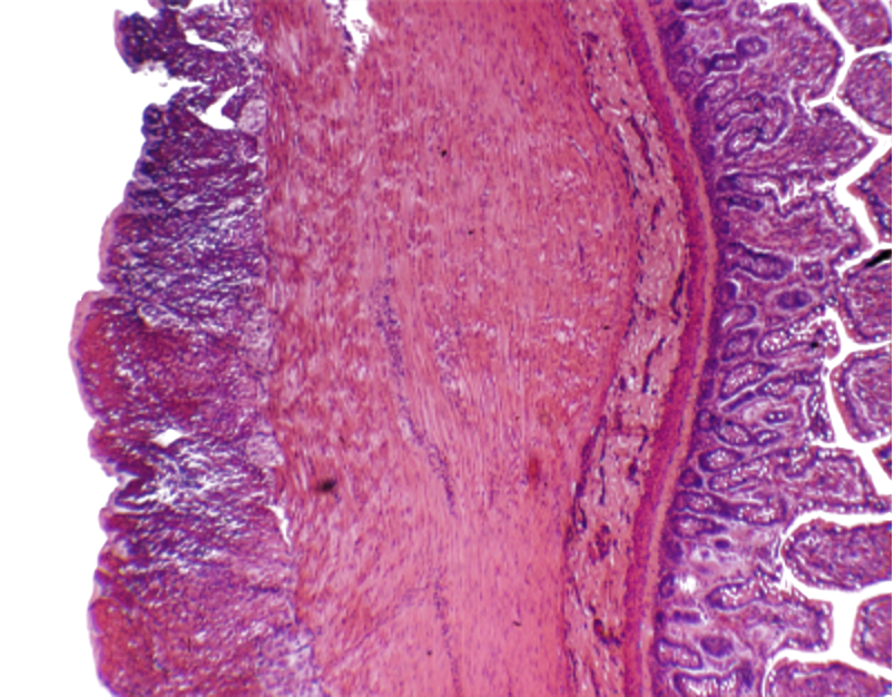 [027002-S60408] Préparation microscopique: Intestin grêle CT