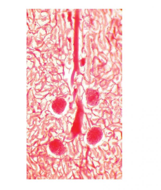 Préparation microscopique: Surrénale en place (sur rein CL) CT