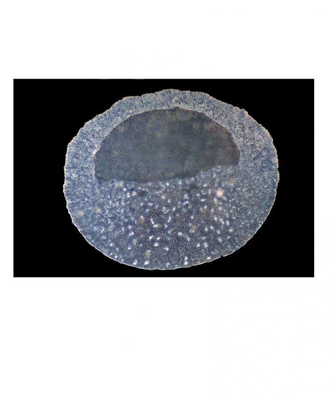 Préparation microscopique: Sperme humain, frottis (giemsa)