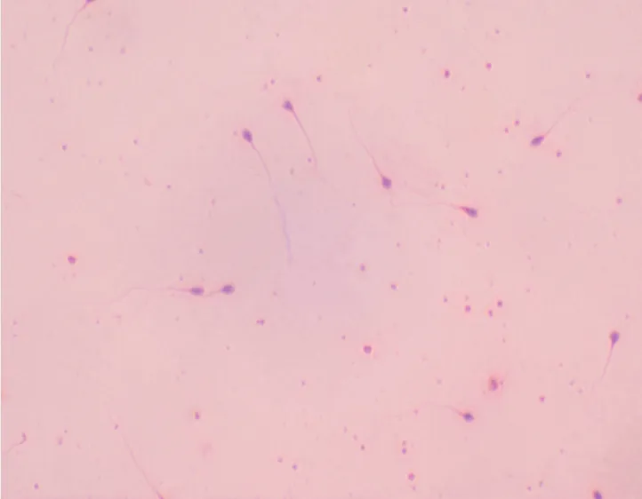 [027010-S01078] Préparation microscopique: Spermatozoïdes humains Frottis 