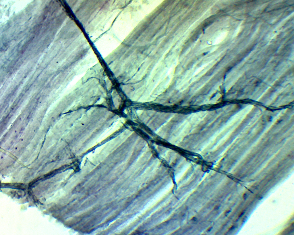 [#027013-S01145] Histologie des vertébrés: Cellules nerveuses moelle - Terminaison de motoneurone - CT