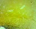 Préparation microscopique: Moëlle épinière lapin CT