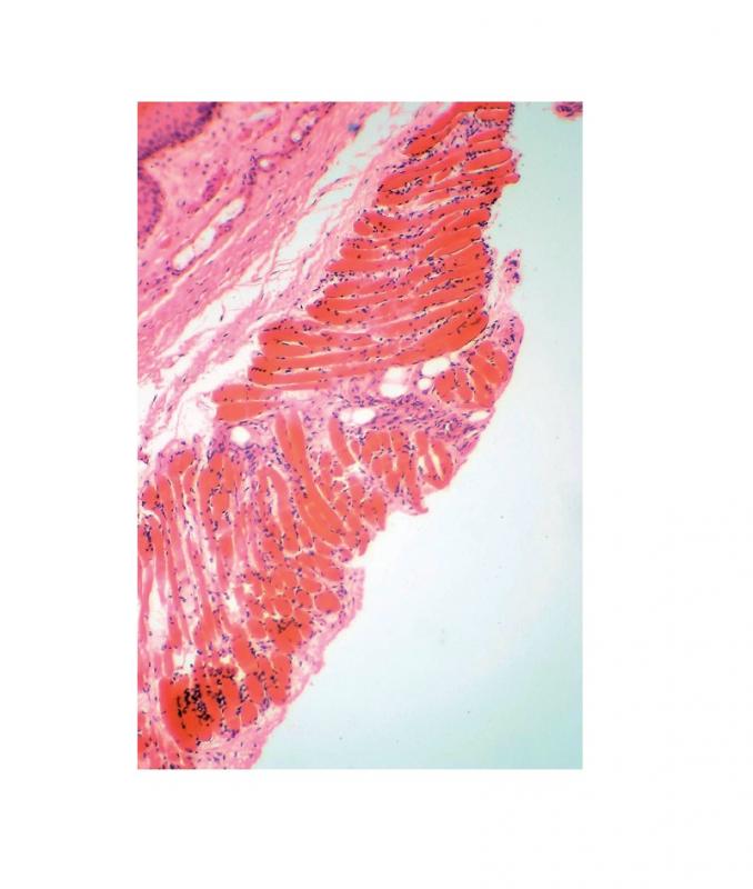 Préparation microscopique: Histologie des vertébrés: Peau  (homme) CT  