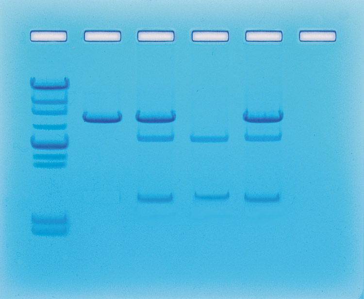 Détection de gènes cancéreux au sein d'une famille