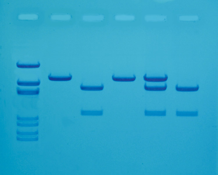 Diagnostic du cholestérol