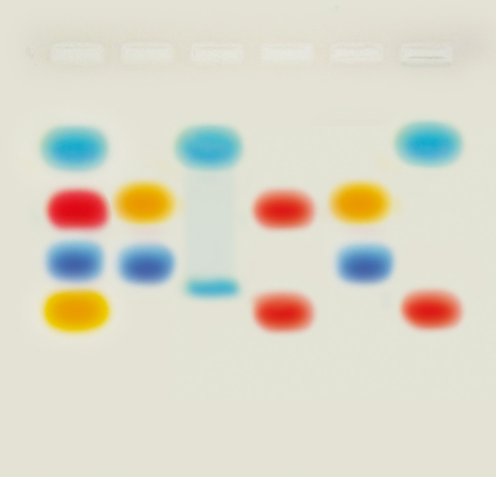 Différentes interprétations d'une électrophorèse sur gel d'agarose