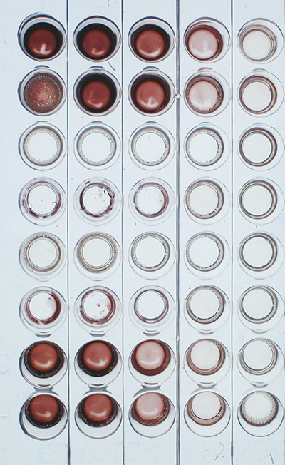 Elisa quantitatif - pour 6 groupes