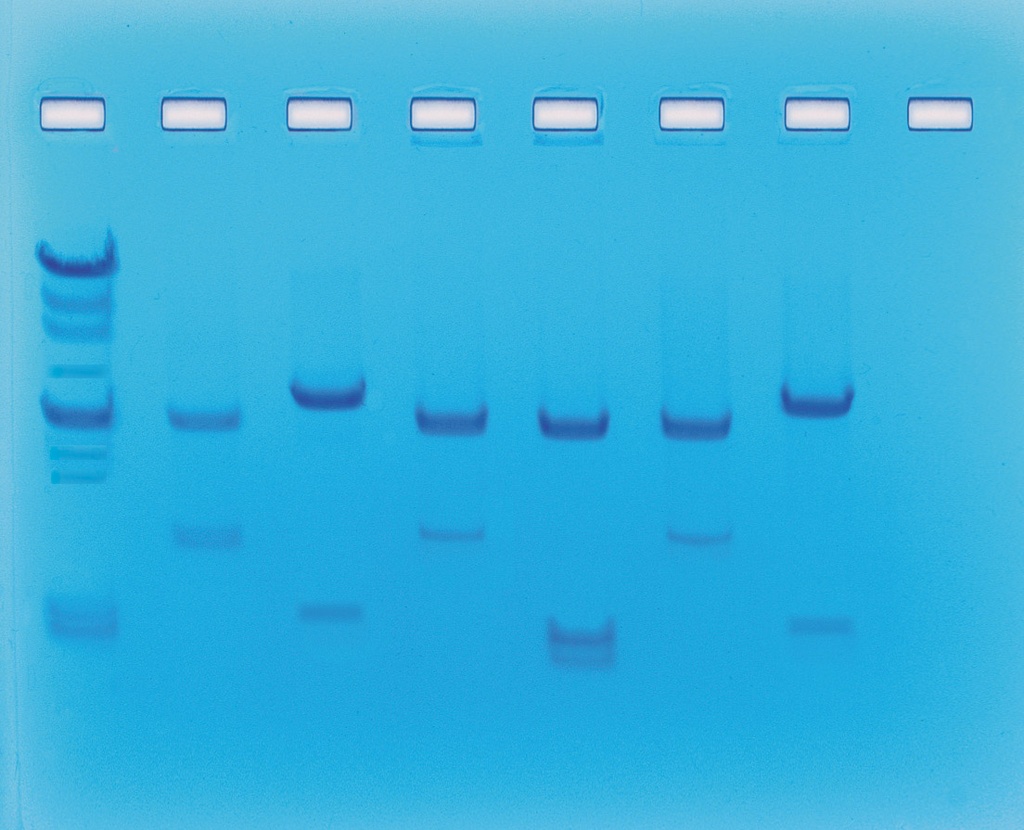 ** Identification génétique à l'aide des enzymes de restriction