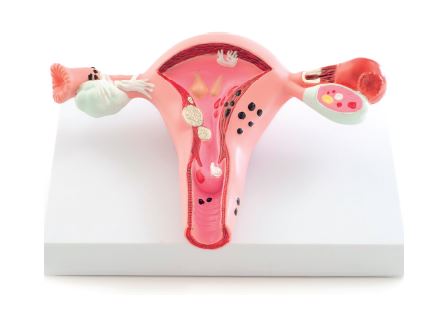Modèle de l'utérus