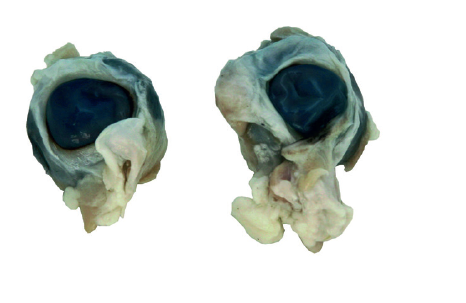 Oeil congelé