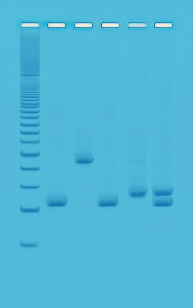 ** Test par PCR multiplex des contaminants de l'eau