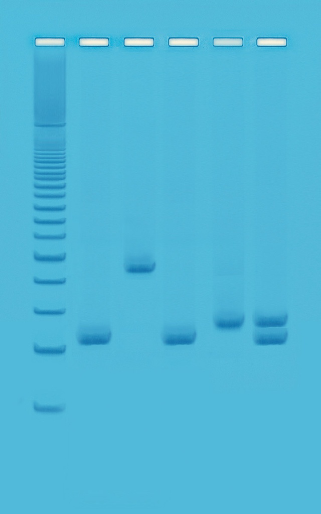 Test par PCR multiplex des contaminants de l'eau
