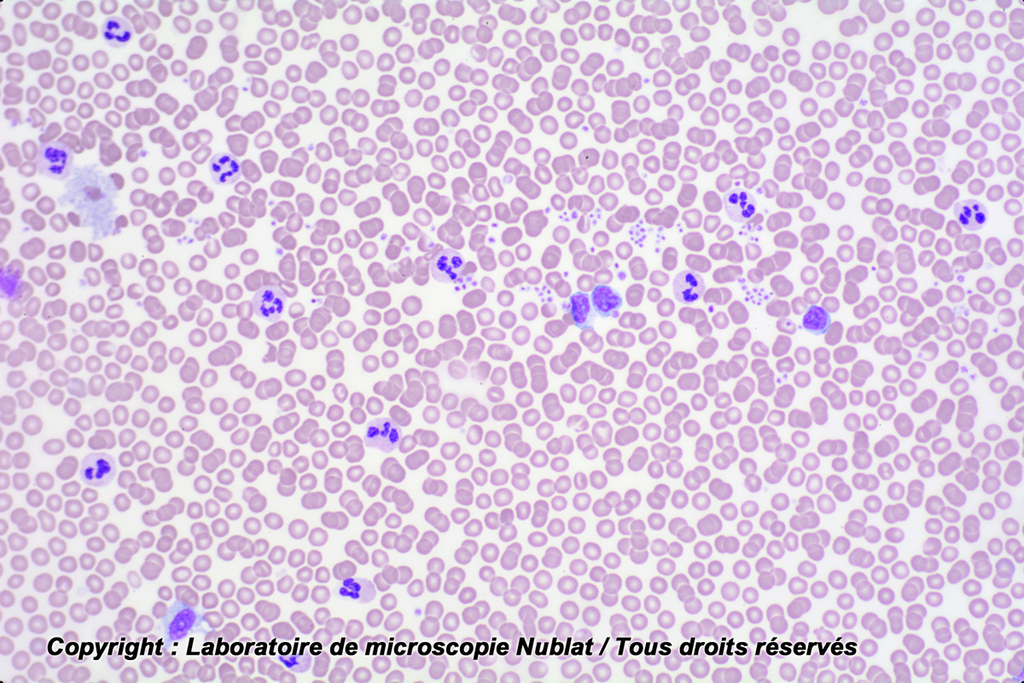 [#027387] Pathologie - Sang humain - septicémie - Nublat