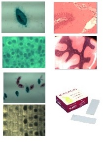 Cytologie et histologie diverses: Nerf optique (tissus conjonctif) CT