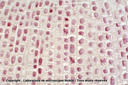 Mitoses - méristème racinaire terminal - Jacinthe - Nublat