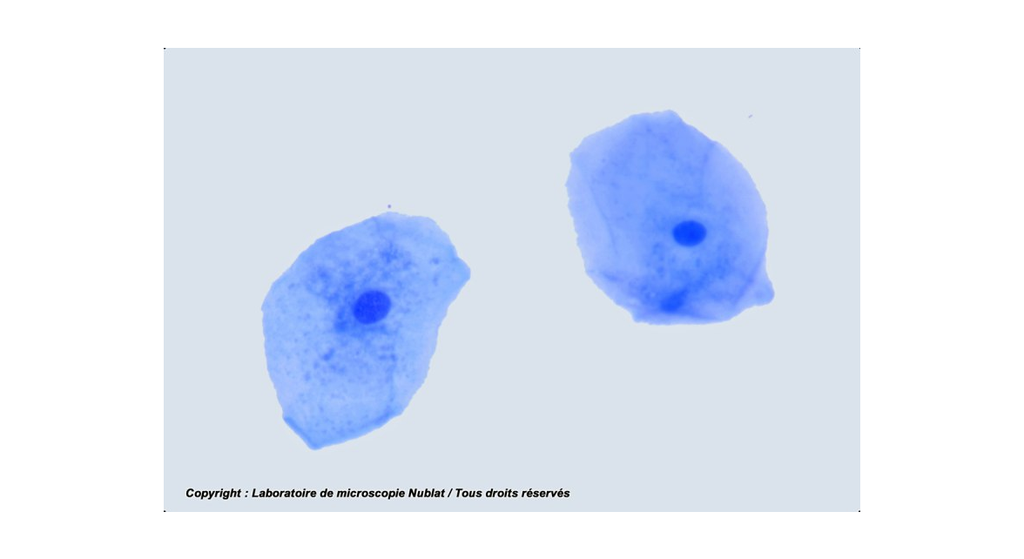 [027500] Cellules épithéliales pavimenteuses - buccales - Nublat