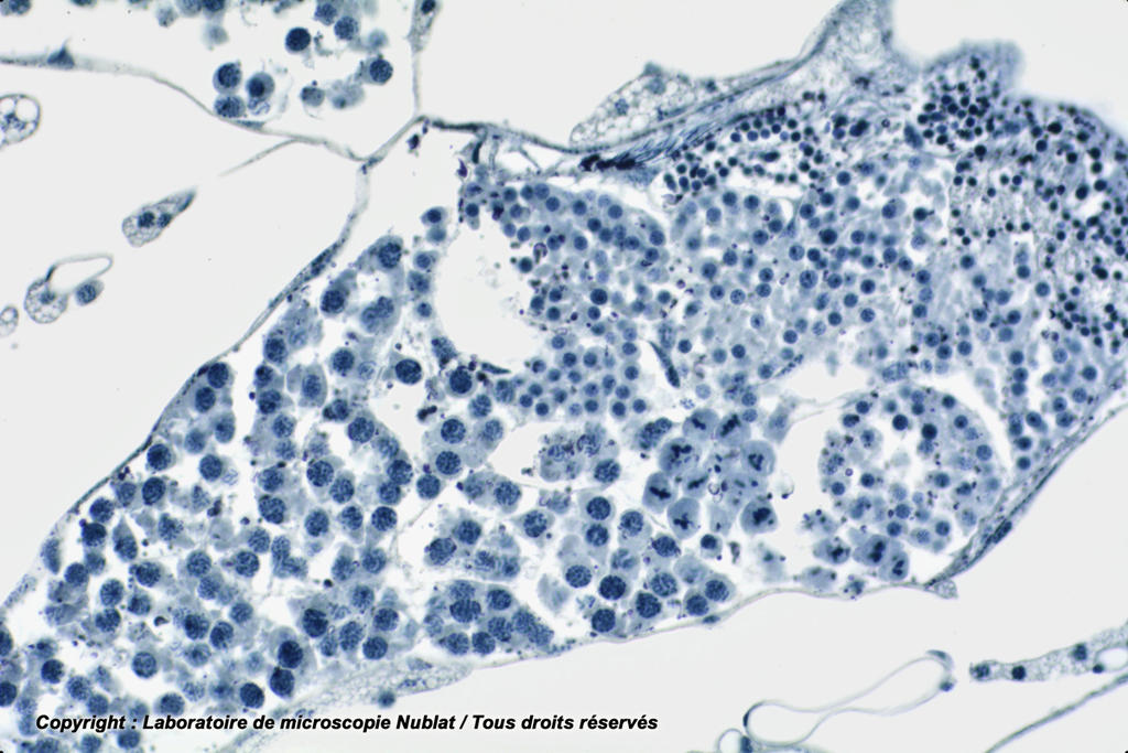 [027506] Méiose - testicule Criquet - Nublat