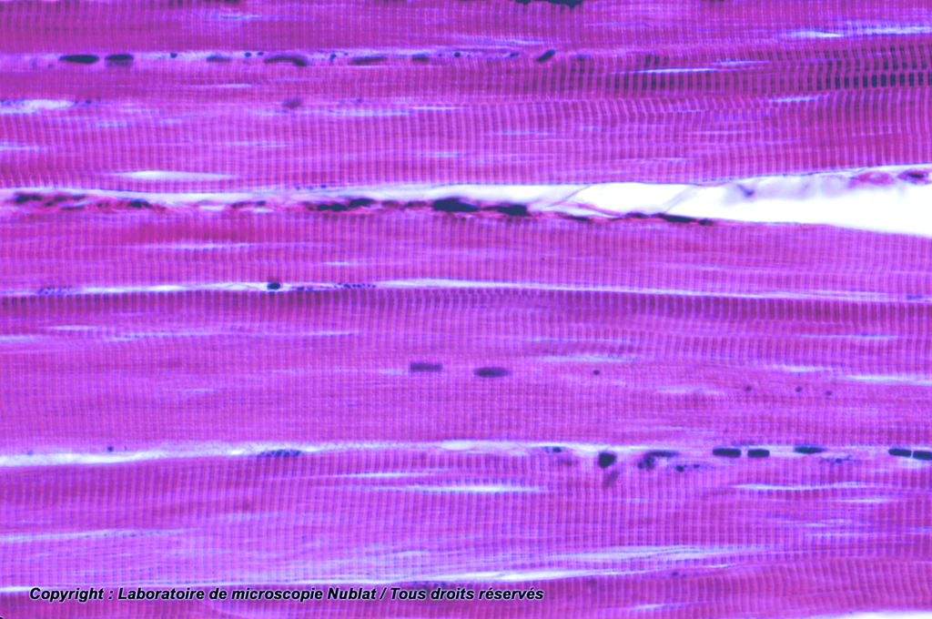 [027532] Muscle strié  - CL - HE - Nublat