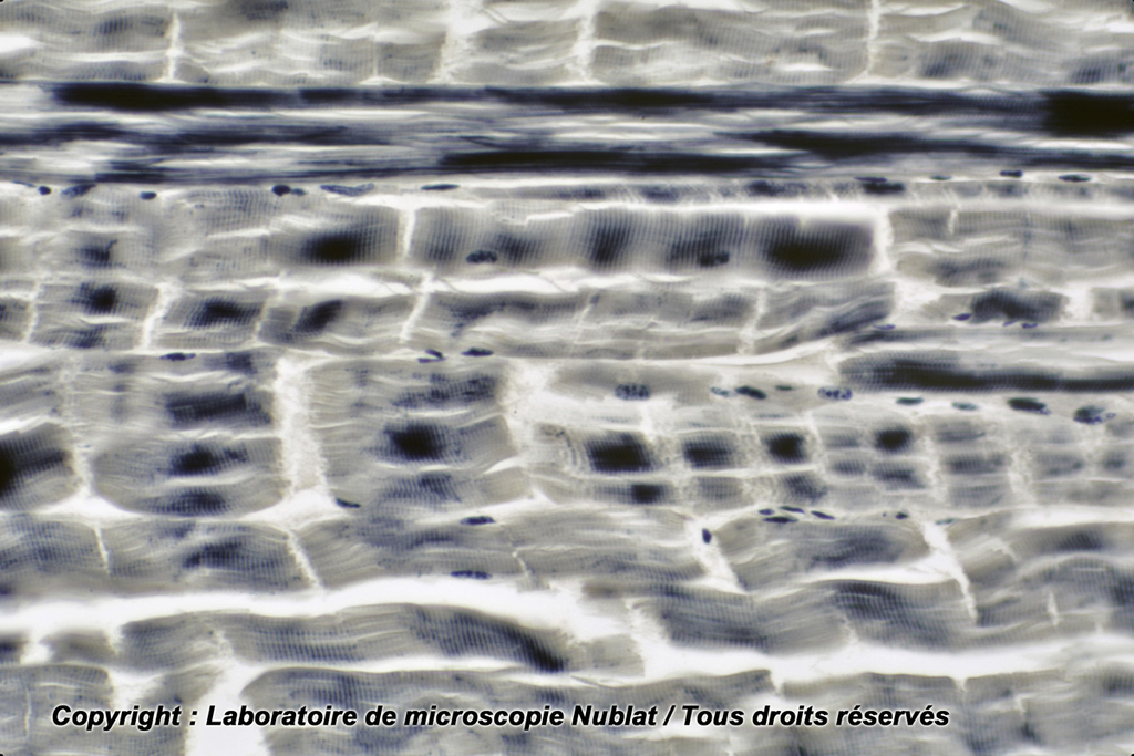 [027533] Muscle strié pour les stries - Nublat