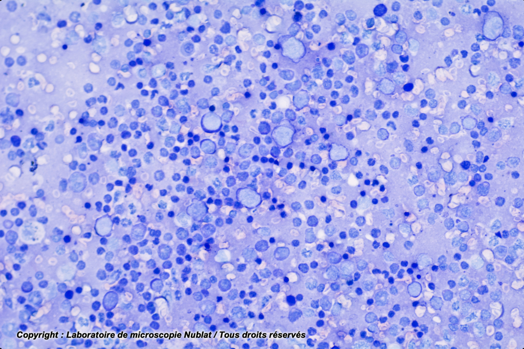 [027585] Frottis de rate : lymphocytes - macrophages et plasmocytes - Nublat