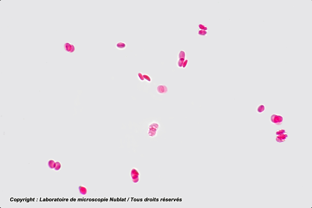 [027587] Absence d’agglutinat -  hématies A+Ac anti B  - Nublat