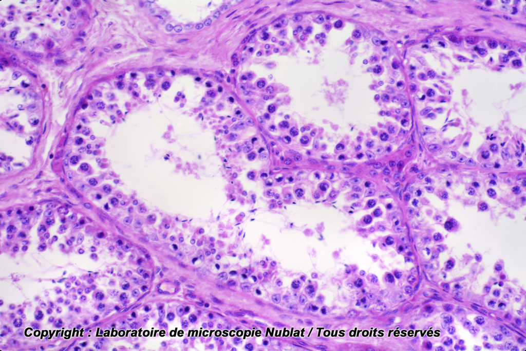 [027595] Testicule - Homme - Nublat