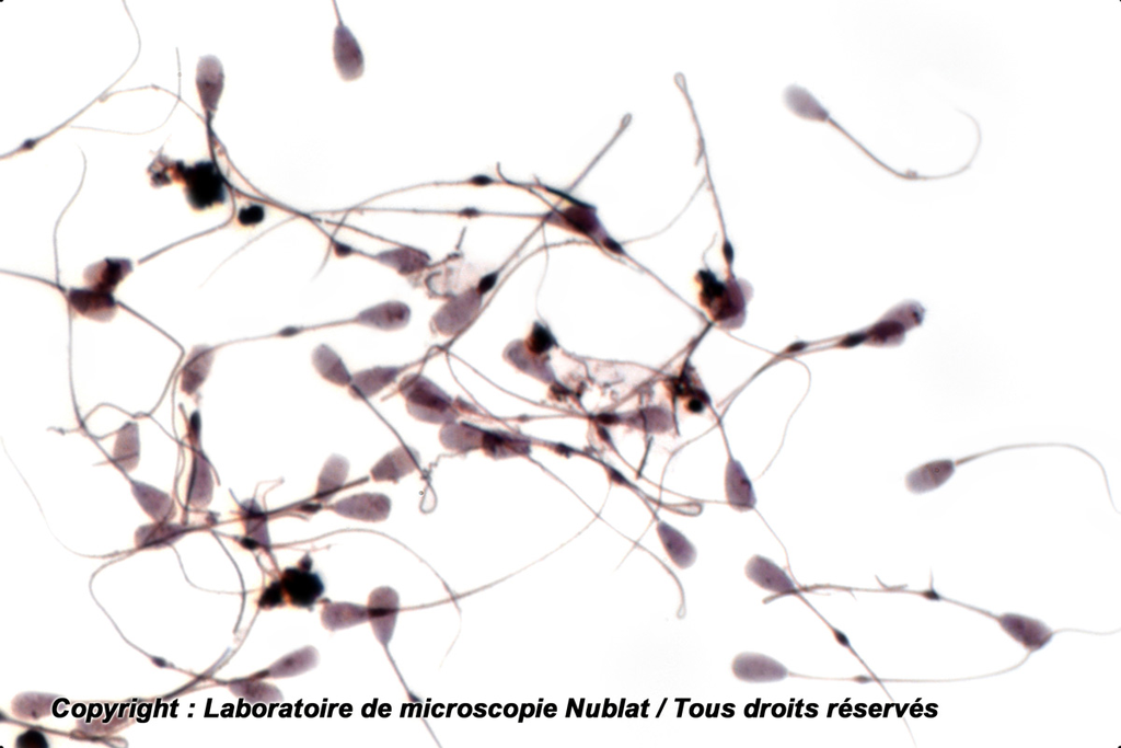 [027599] Spermatozoïdes - Taureau - Nublat