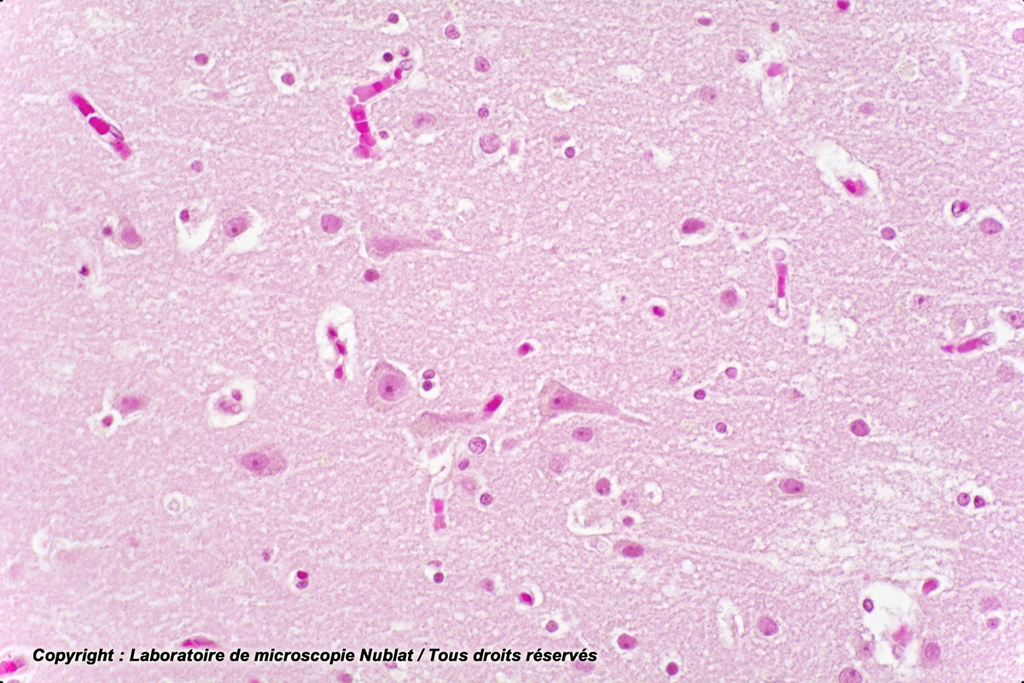 [027621] Cerveau - Homme - Nublat