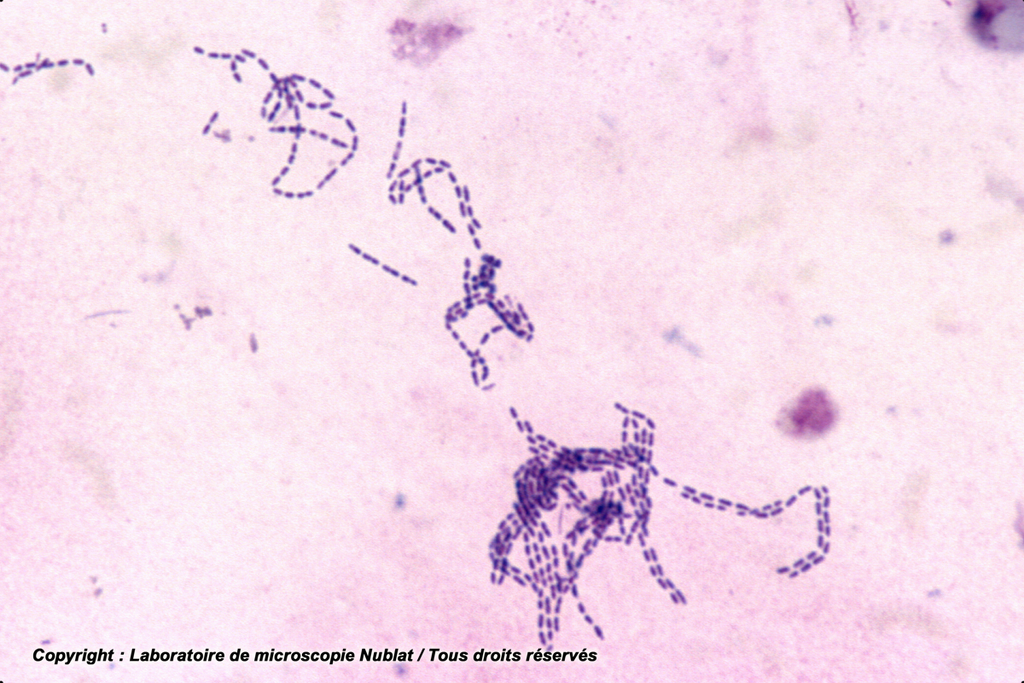 [027923] Streptocoques - Nublat