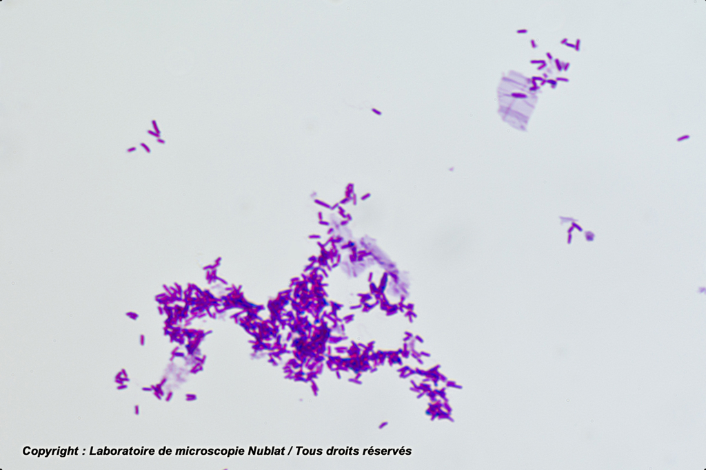 Escherichia coli - Nublat
