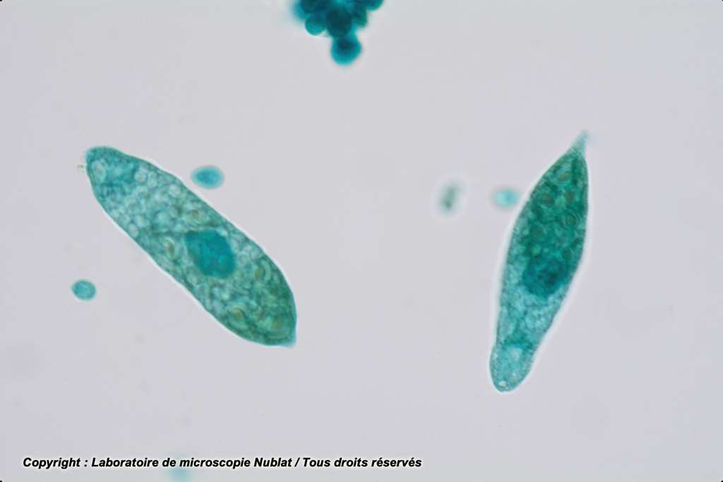 Phytoflagellés : Euglènes - VL - Nublat