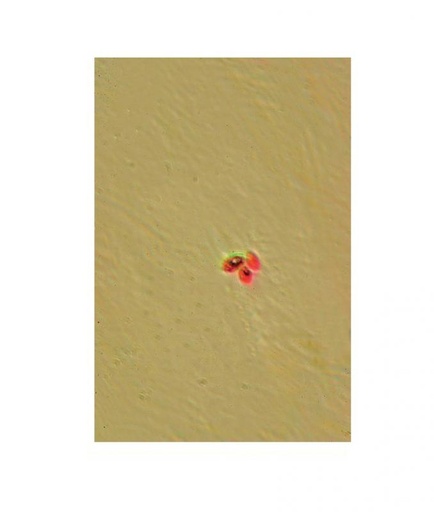 [027175-S60483] Préparation microscopique: Mucor reproduction asexuée