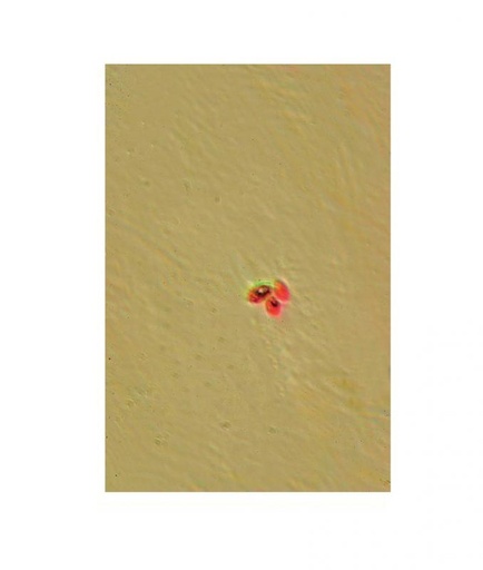 [S67949] Préparation microscopique: Spores de champignons