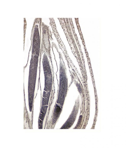 [S60497] Préparation microscopique: Archégone de mousse pied femelle
